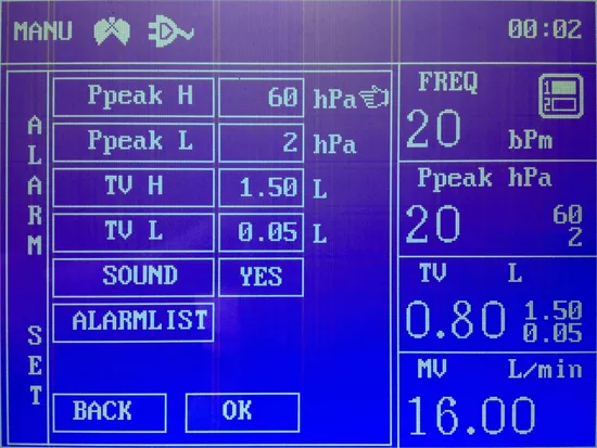 Surgical Operation Room Medical Anesthesia Machine